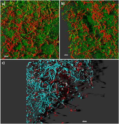 Fungal Biofilms: Targets for the Development of Novel Strategies in Plant Disease Management